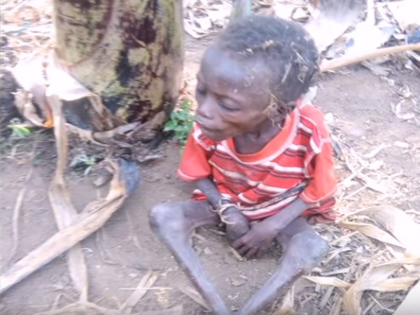 A 12-Year-Old Boy Saved From Deliberate Starvation By An Aunt
