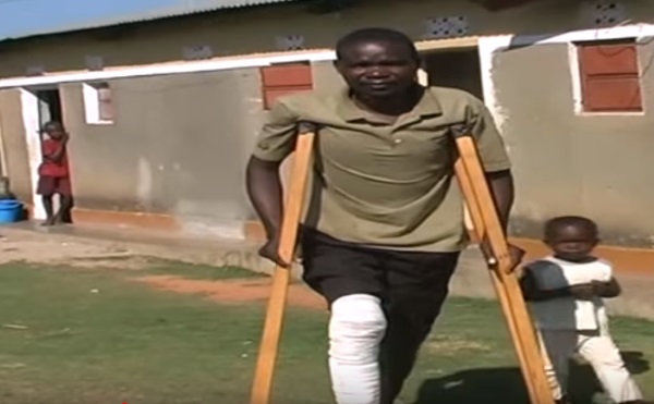 Man Knocked Down By Gen Odongo’s Driver Seeks Help